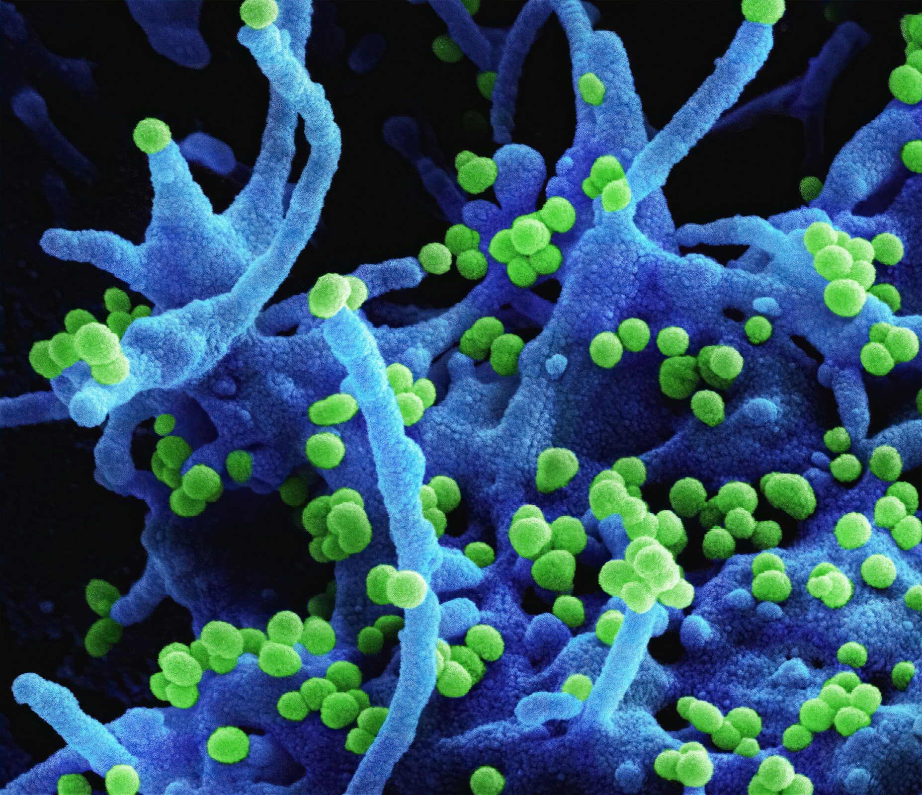 a close up of a blue and green substance